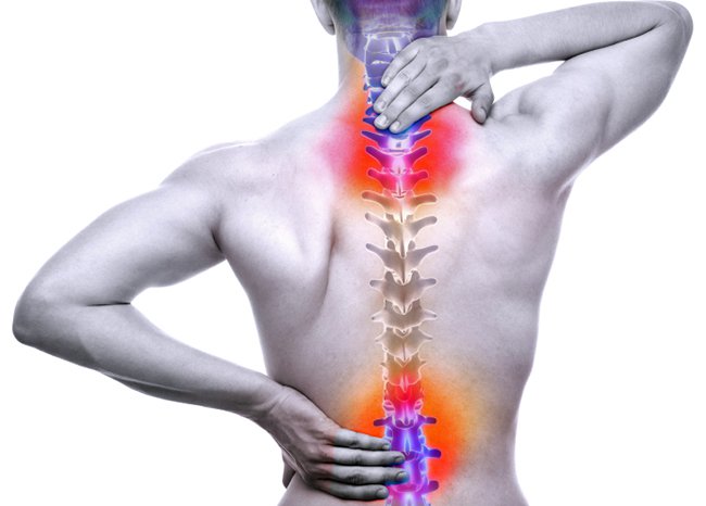 Spinal-cord Injury Lawsuits